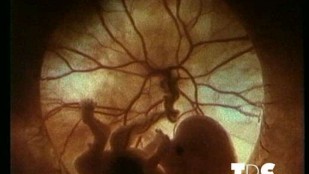 Loi bioéthique : Pour qui, pour quoi ?